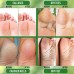 PurOrganica Urea 40 Percent Foot Cream - Bundle with Pumice Stone and Brush - Callus Remover - Moisturizes & Re